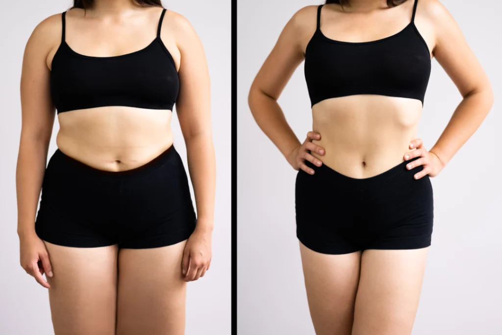 A before-and-after comparison showing significant weight loss results achieved with Semaglutide treatment.