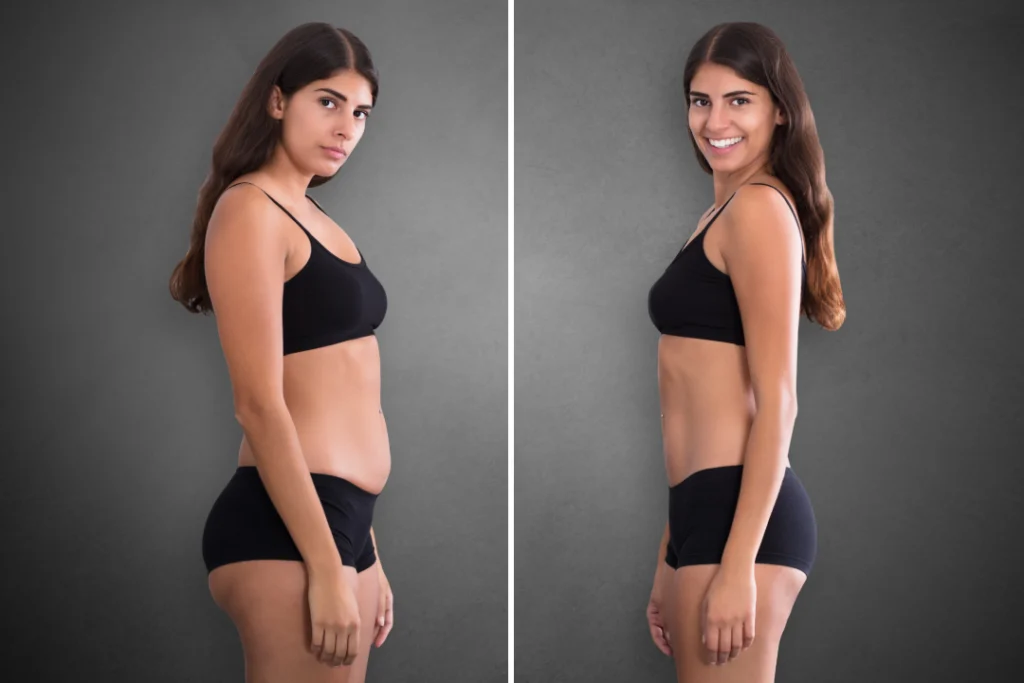 Before and after image of a woman showing noticeable weight loss results achieved with tirzepatide.