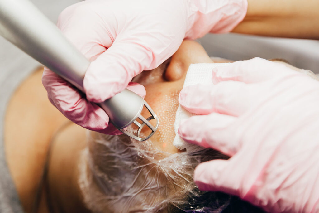 close-up of gloved hands using a laser device on a person’s face wrapped in protective film