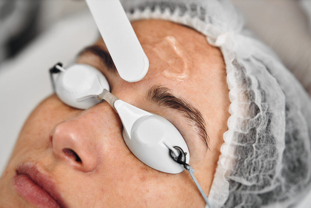 Close-up of a patient preparing for IPL treatment with protective eyewear.