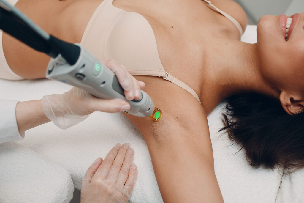 Hair removal laser treatment on underarm at medspa.