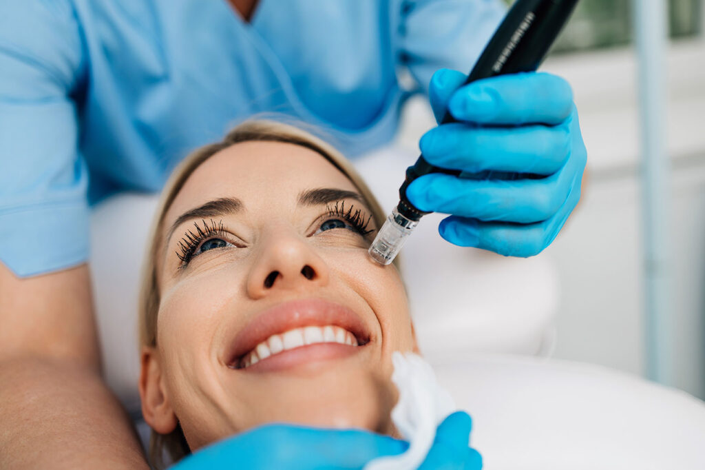 Gloved provider holding a microneedling device near a woman’s cheek during a facial procedure.