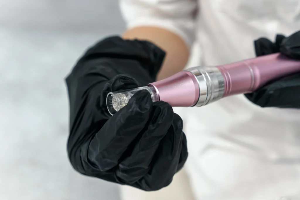 Gloved hands holding microneedling pen device with needle tip visible